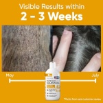 Salmon Oil for Dogs - Premium Fish Oil for Skin and Coat Health - Omega 3 Supplement - Supports Itchy Skin - 8 oz Liquid - Norwegian Dog Salmon Oil - Essential Dog Supplement - Image 8